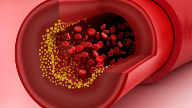 Cholesterol in bloods