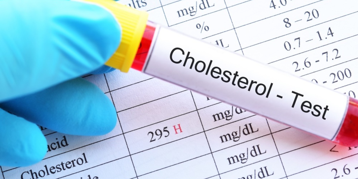 Cholesterol in blood